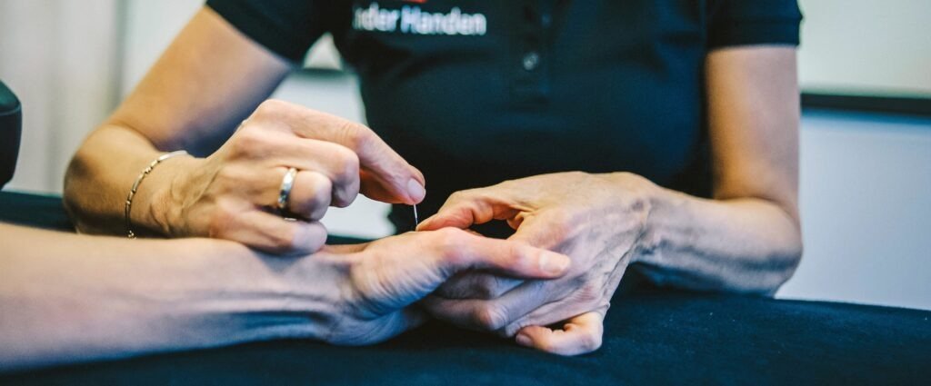 Reasons for Needing Hand Physiotherapy
